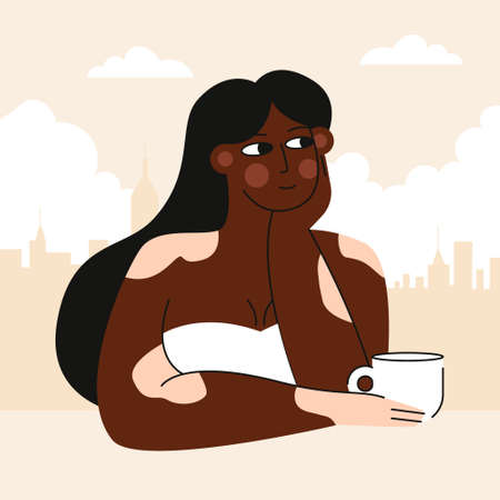 Flat vector illustration. Portrait of an Afro American woman with vitiligo skin disease. Self-acceptance. Another beauty. World vitiligo day.のイラスト素材