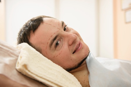 Man face with medical contours at skinの写真素材