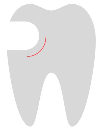 perforated tooth illustrationのイラスト素材