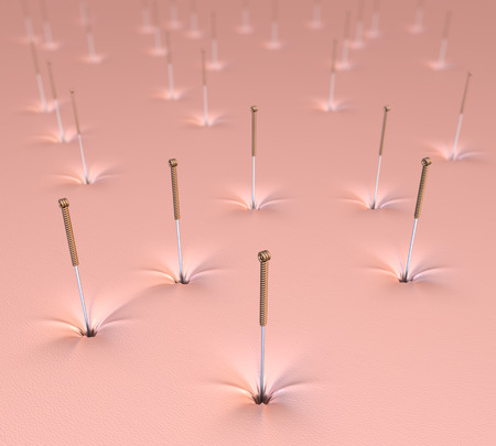 Gold and silver acupuncture needles in plain of skin, 3d renderingの写真素材