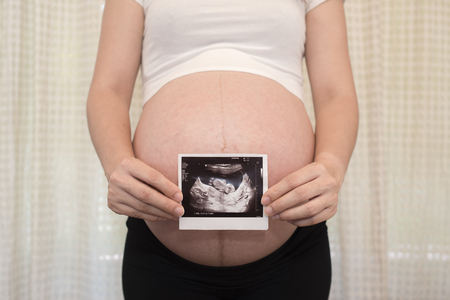Pregnant woman show ultrasound baby photos, baby coming soon on the worldの写真素材