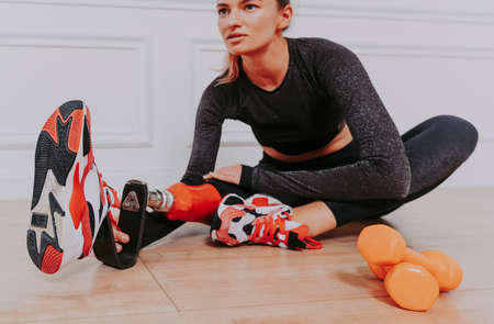 Beautiful young woman with amputation - Pretty and confident woman with leg disability, amputee posing against body shamingの写真素材