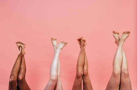 Group of multiethnic women with different kind of skin posing together in studio. Concept about body positivity and self acceptanceの写真素材