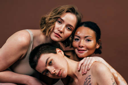 Group of multiethnic women with different kind of skin posing together in studio. Concept about body positivity and self acceptanceの写真素材