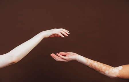Group of multiethnic women with different kind of skin posing together in studio. Concept about body...