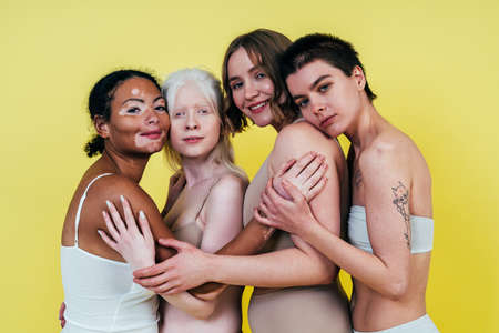 Group of multiethnic women with different kind of skin posing together in studio. Concept about body positivity and self acceptanceの写真素材