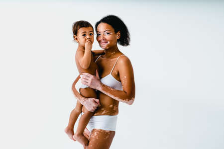 Happy black woman with vitiligo holding her baby on colored background - Young woman wearing underwear taking care of her little son - Pregnancy, motherhood, people and expectation conceptの写真素材
