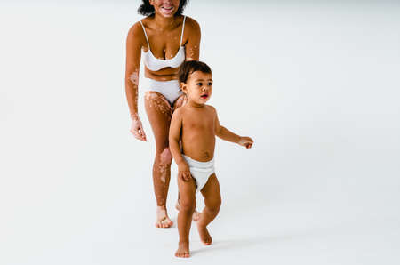 Happy black woman with vitiligo holding her baby on colored background - Young woman wearing underwear taking care of her little son - Pregnancy, motherhood, people and expectation conceptの写真素材