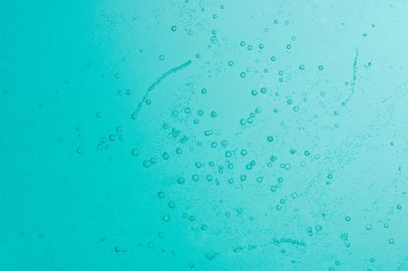 water bubbles