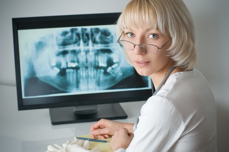 Doctor looking at x-ray on computerの写真素材