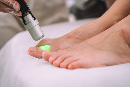 Close up shot of gloved hand with the laser hair removal machine's handpiece along woman leg. Alexandrite laser techhnology removing hair. Beauty procedureBeauty technology conceptの写真素材