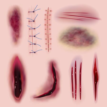 Stitching realistic. Coloring bloody scars cuts different wounds medicine or horror collection. Illustration realistic surgical injury, gash and traumaのイラスト素材