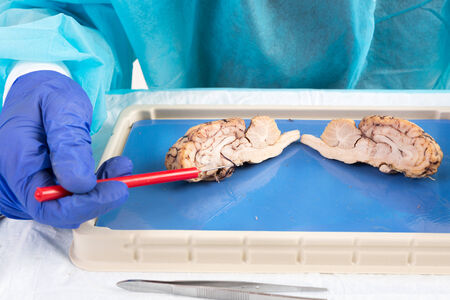 Cross-section of a cow brain in a laboratory with an anatomy student pointing with a probe to the area of the pituitary gland and hypothalamus as it lies on a dissecting tray during classの写真素材