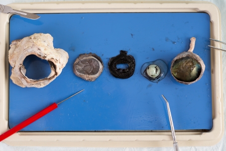 Dissecting a sheep eye with the various tissues displayed on a tray including the eyeball, lens and surrounding muscle from the eye socketの写真素材