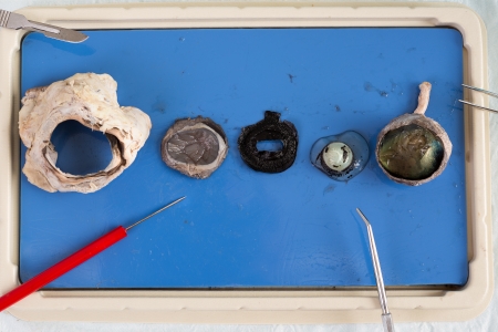 Dissecting a sheep eye with the various tissues displayed on a tray including the eyeball, lens and surrounding muscle from the eye socketの素材 [FY31024608196]