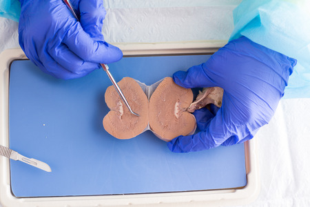 Anatomy student dissecting a preserved sheep kidney working with a cross section looking at the structure of the renal systemの写真素材