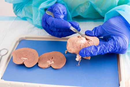 Medical student in anatomy class dissecting a sheep kidney working with a whole kidney looking at the irater and capsule, and also a cross section showing the internal tissue structure, close upの写真素材