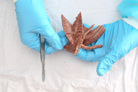 Medical researcher holding fetal pig lungs with blue protective glovesの写真素材