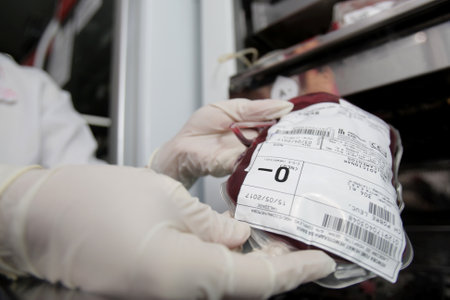 salvador, bahia / brazil - april 06, 2017: Donated blood bag in blood center in Salvador city. The blood is distributed to public hospitals in Bahia.のeditorial素材