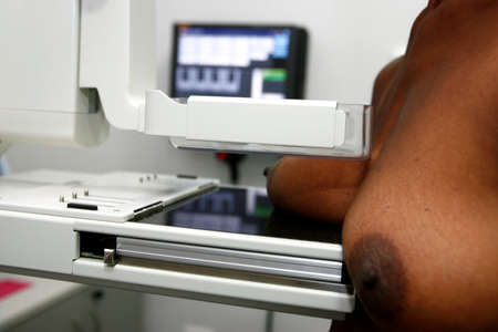 salvador, bahia / brazil - october 22, 2014: woman is seen during mammography exam to detect breast cancer in the city of Salvador.のeditorial素材