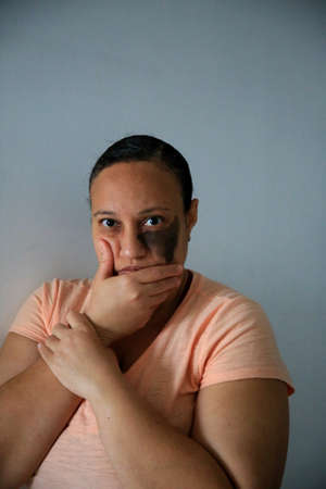 salvador, bahia, brazil - august 9, 2021: Woman victim of domestic violence is seen in Salvador...
