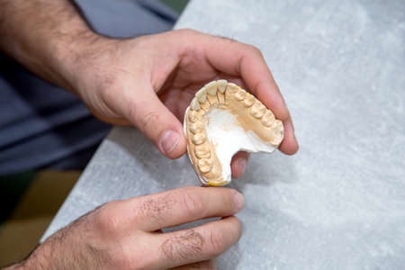 doctor working with a layout of teeth. Mold of teeth in the hands of a doctor