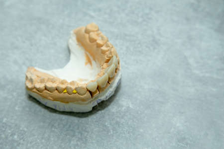 layout of teeth on the table Dental impression of teethの写真素材