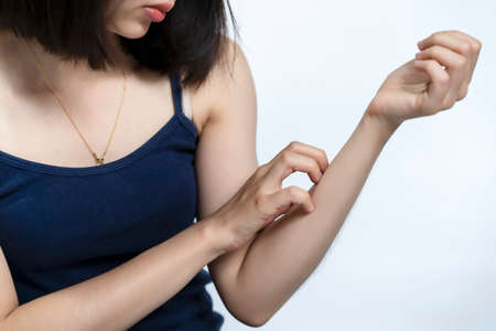A woman scratching wrist due to a foreign body intolerance or an insect bite.の写真素材