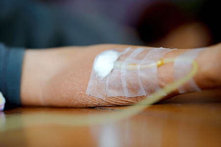 Close-up arm of a male patient who was injected with saline into a vein.の写真素材