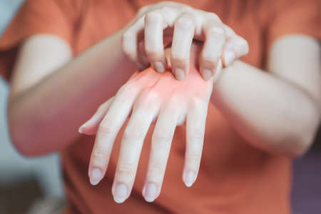 The woman's hand had a red rash and itching, so she scratched due to an insect bite or allergy to...