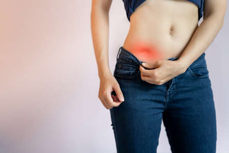 Women's scars caused by abdominal surgery, such as appendicitis. Health care concept.の写真素材