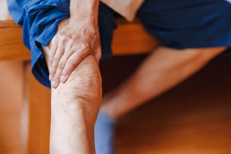 Elderly women have knee pain due to osteoarthritis. Concept of health problems in the elderly.の写真素材