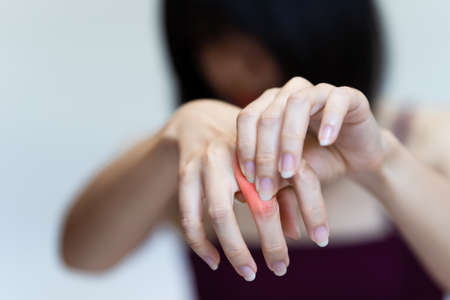 Woman has pain in her knuckle due to rheumatoid arthritis.
