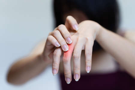 Woman's knuckle pain, Signs of osteoarthritis.の写真素材