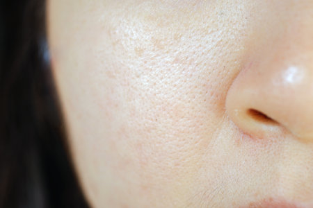 The skin of a woman's face with large pores and oily skin.の写真素材