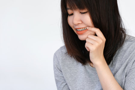 Woman wearing braces and pointing at braces due to pain from.の写真素材