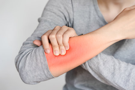 Close-up image of a person in a gray shirt touching their red swollen arm, indicating pain or irritation.の写真素材