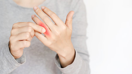 A close-up of a person experiencing discomfort in their hand, highlighting a red irritation on the skin, suggesting inflammation.の写真素材
