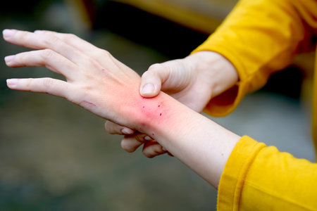 Close-up of a woman's arm showing fresh cat bite marks, while wearing a yellow shirt, illustrating pet-related injuries.の写真素材