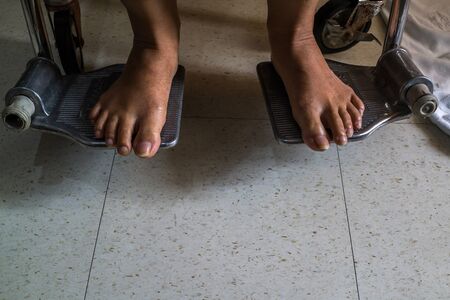 Feet of patient sitting on old rusty wheelchair in a room.の写真素材