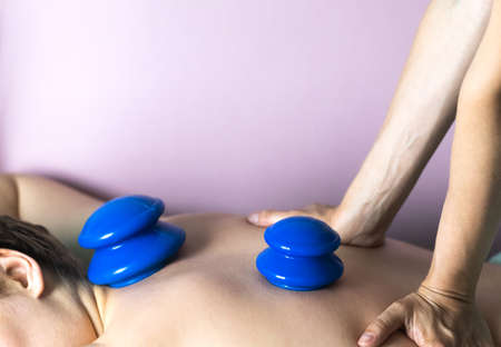 The postpartum doula placed vacuum silicone cups on the womans back.の写真素材