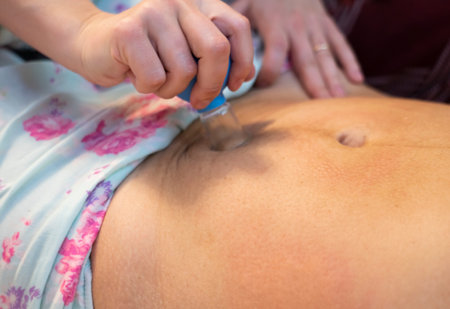 Postpartum doula shows how to massage a cesarean scar with a vacuum jar. Recovery procedures after childbirth.の写真素材