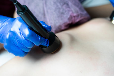 The masseuse makes an ultrasonic massage on the woman's back. She holds the maniples in blue gloves....