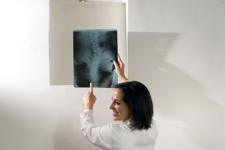 Female Doctor points at an x-ray of a person's spine while she smiles and laughs. Horizontally...