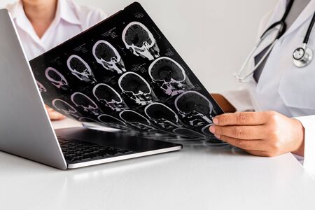 Female doctors, specialists in treatment, make an appointment to meet patients after x-ray and give advice, explain medical information and diagnose the disease. Concept of treatment and good health.の写真素材