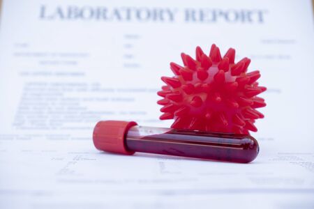 samples of blood tests to diagnose coronary virus infections analysis and sampling of infectious...