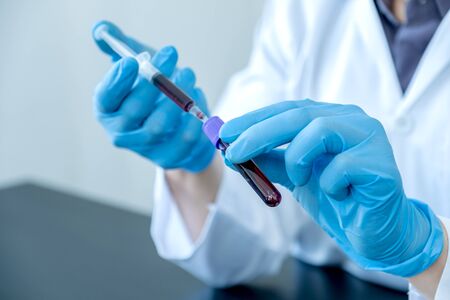 Professional doctors perform find virus tests from samples of blood tests to diagnose coronary virus...