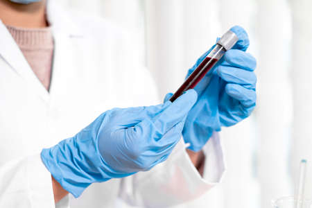 Professional doctors perform find virus tests from samples of blood tests to diagnose coronary virus...
