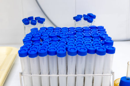 set of plastic laboratory sample tubes with blue screw caps in a metal rack, placed on a clean...