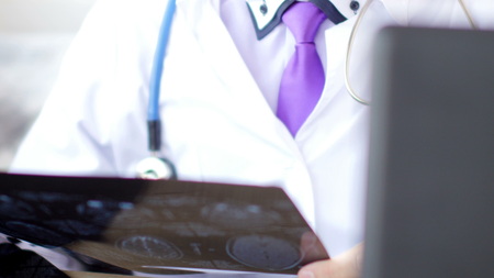 Doctor in hospital looking at MRI scan of head.の写真素材